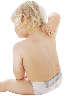 A baby sits with his back turned in a white diaper, itchy and waiting for natural remedies for baby eczema